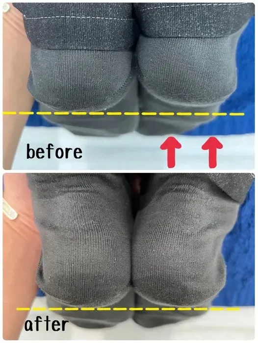 骨盤矯正と脚周りの施術で長さを整えます💁♂️