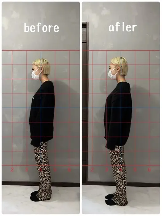 ストレートネックと巻き肩が酷いネイリストさん