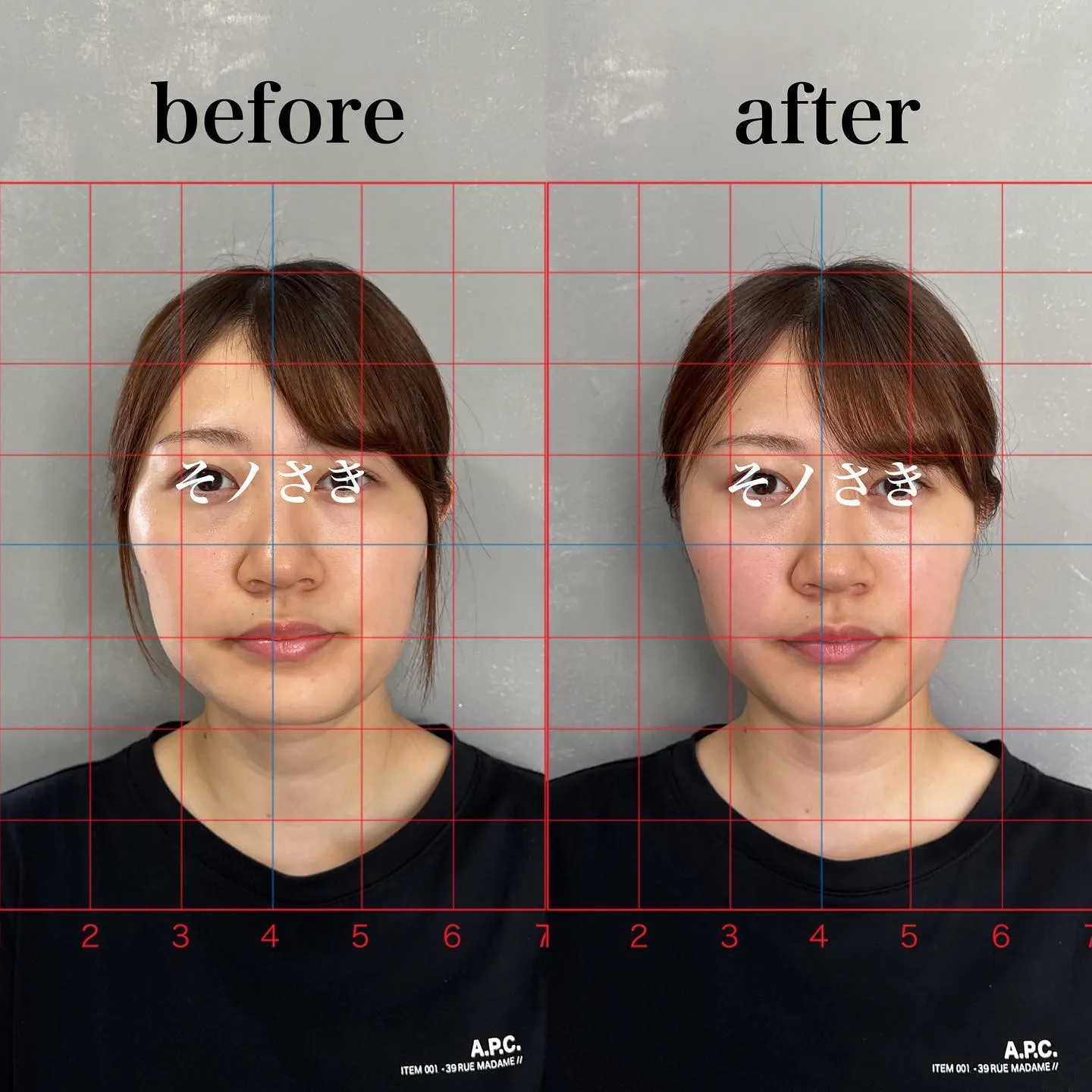 🔥過去1のビフォーアフター🔥