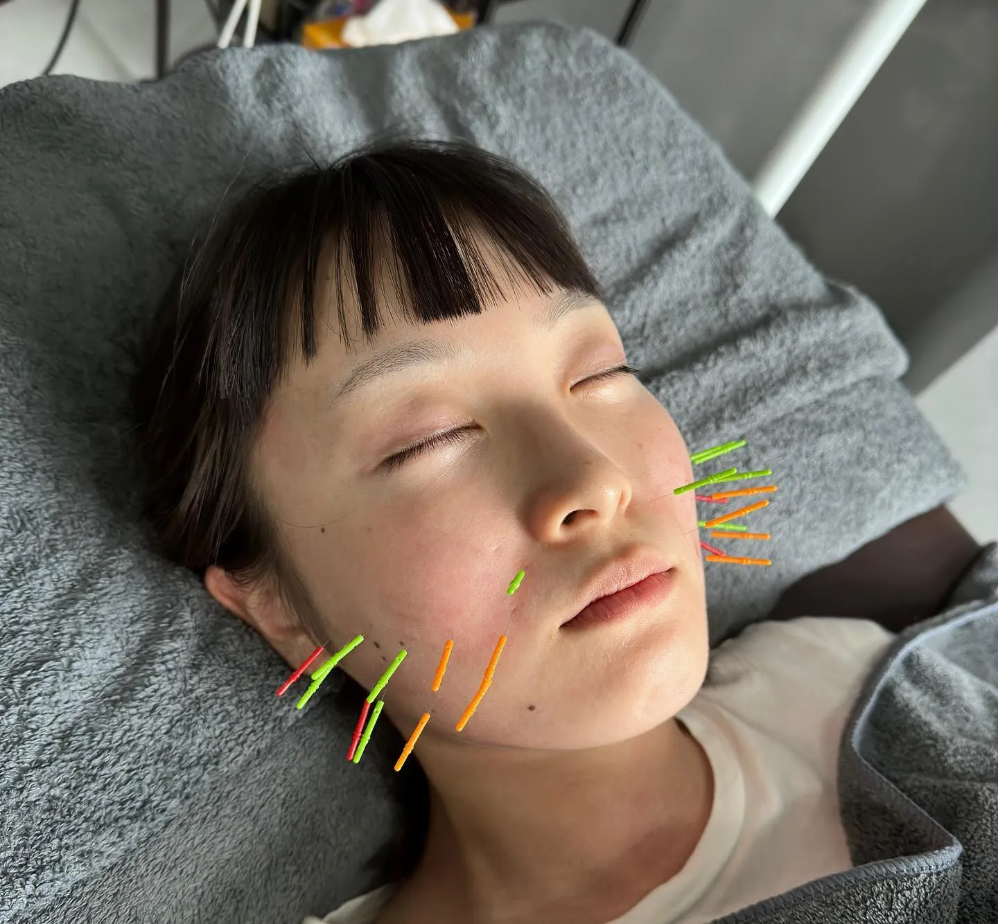 🔥オプションでお得に鍼を🔥